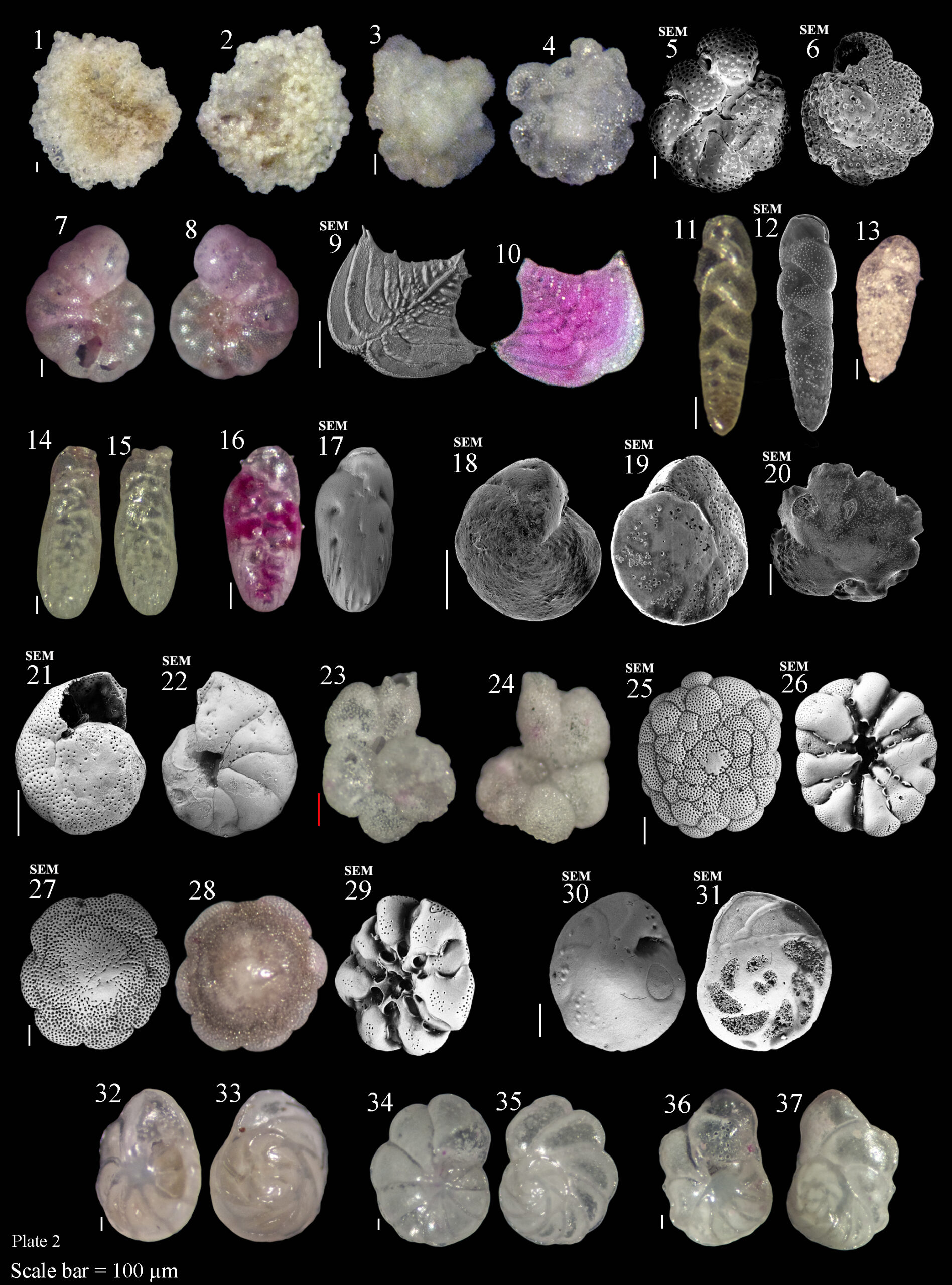 Read more about the article From the Ocean Depths to the Shore: New Research Uncovers the Link Between Foraminifera and South Pacific Reef Ecology